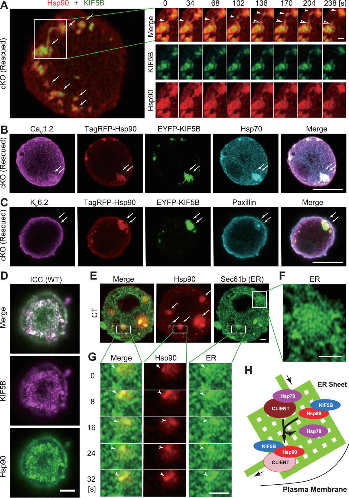 Kinesin-1 mediates proper ER folding of the CaV1.2 channel and maintains  mouse glucose homeostasis | EMBO Reports, image size:1200x1711