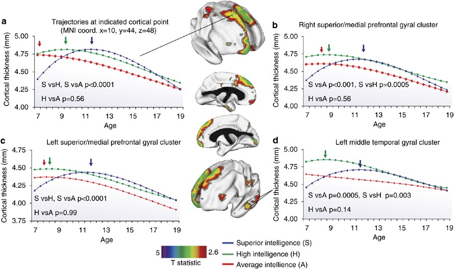dihexa neuroplasticity Molecular Foundations of Neuroplasticity in Brain Tumours: From Microscopic  Adaptation to Functional Reorganisation main image 1