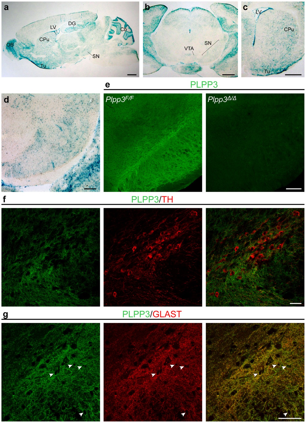Neural ablation of the PARK10 candidate Plpp3 leads to dopaminergic transmission deficits without neurodegeneration | Scientific Reports neural-ablation-of-the-park10-candidate-plpp3-leads-to-dopaminergic-transmission-deficits-without-neurodegeneration-scientific-reports