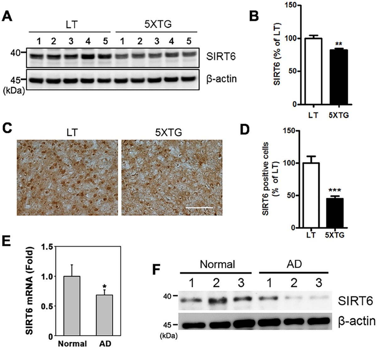 p53-dependent SIRT6 expression protects Aβ42-induced DNA damage | Scientific Reports p53-dependent-sirt6-expression-protects-a-42-induced-dna-damage-scientific-reports