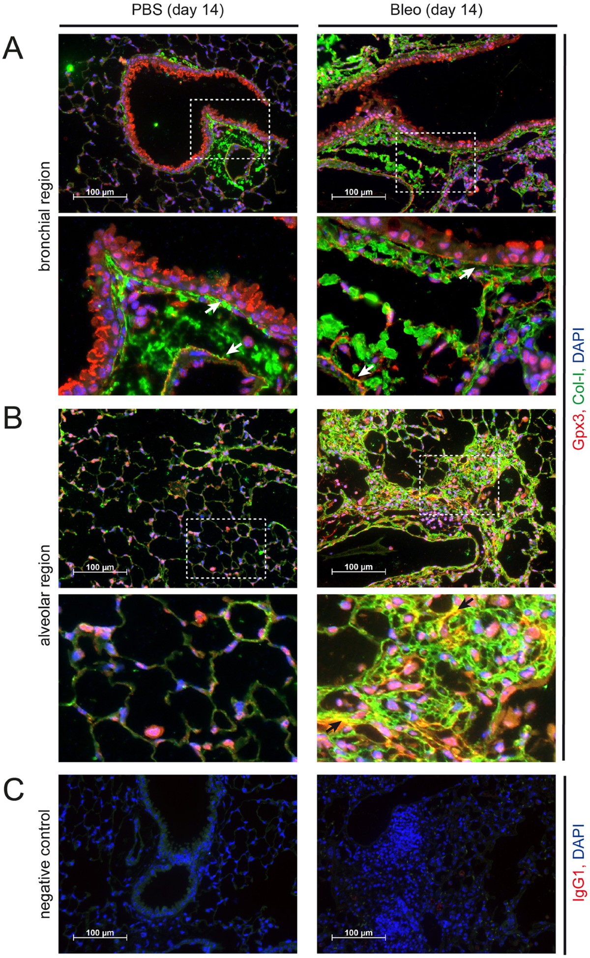 liposomal encapsulation protects glutathione from digestion Liposome mediated encapsulation and role of chitosan on modulating liposomal  stability to deliver potential bioactives-A review