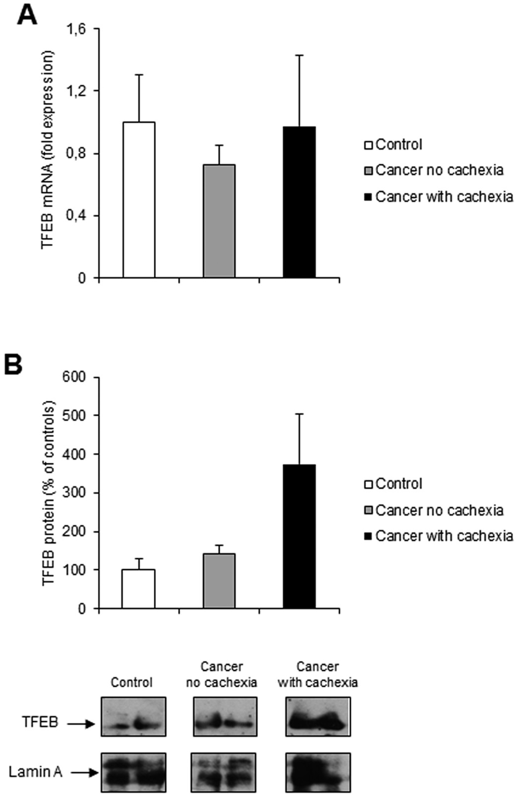 Autophagy is induced in the skeletal muscle of cachectic cancer patients |  Scientific Reports