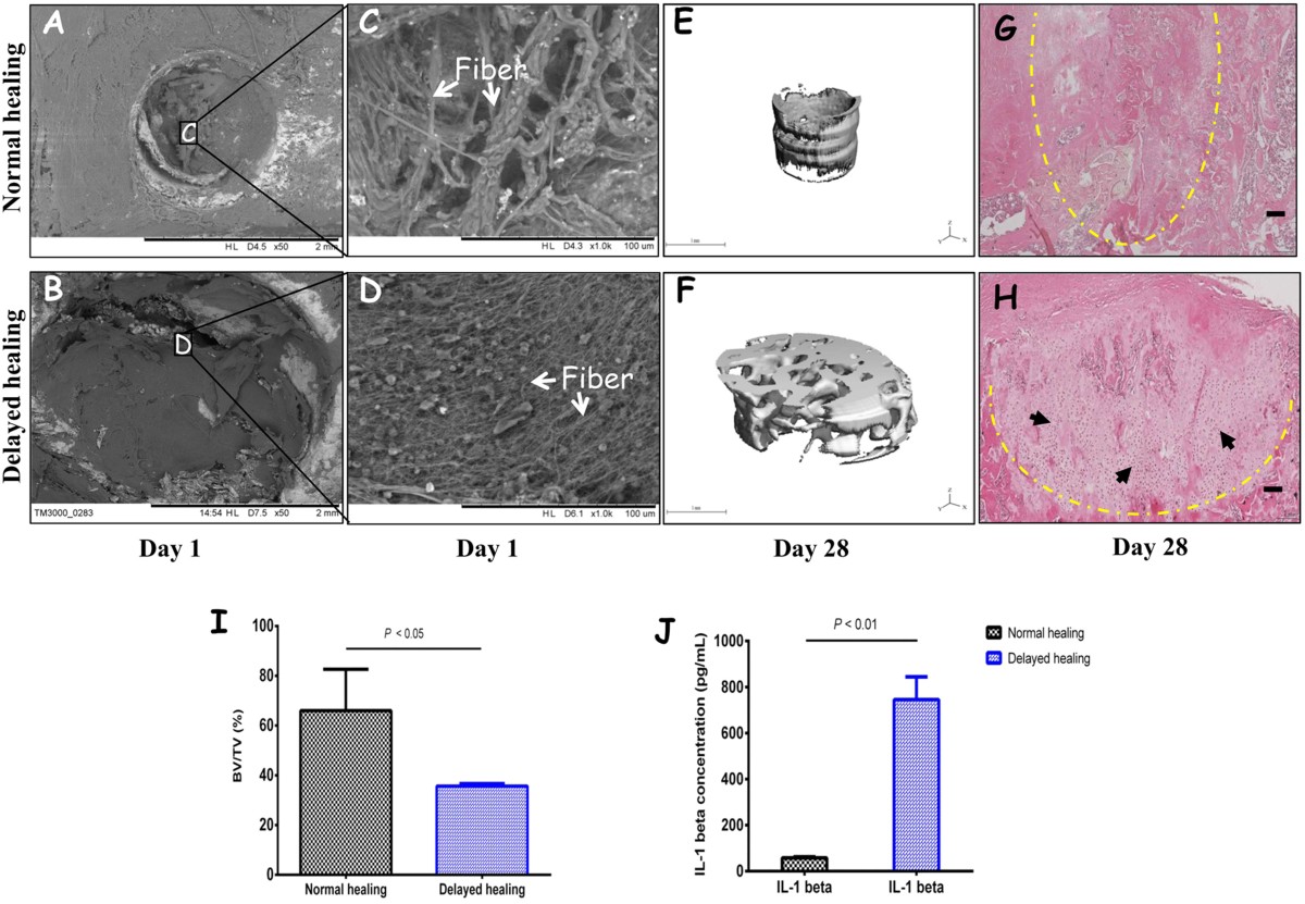 glutathione reduced breaks up blood clots Alteration of blood clot structures by interleukin-1 beta in association  with bone defects healing