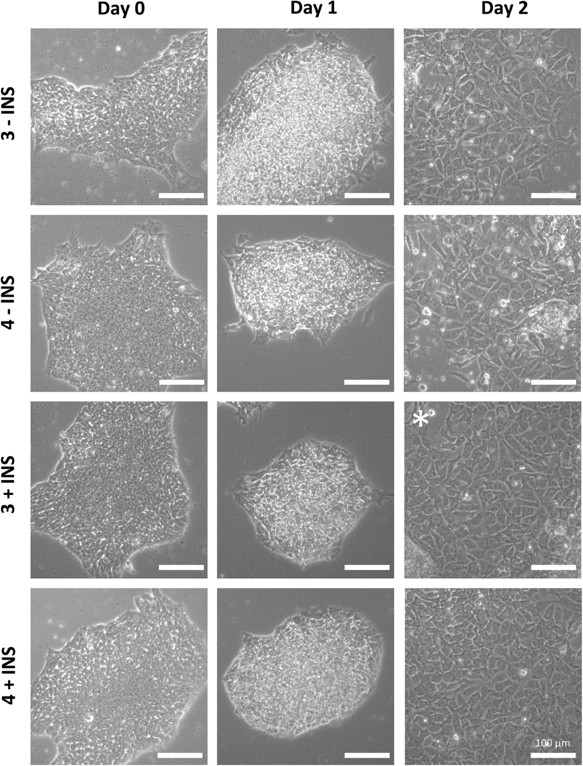 Development of a rapid screen for the endodermal differentiation potential  of human pluripotent stem cell lines