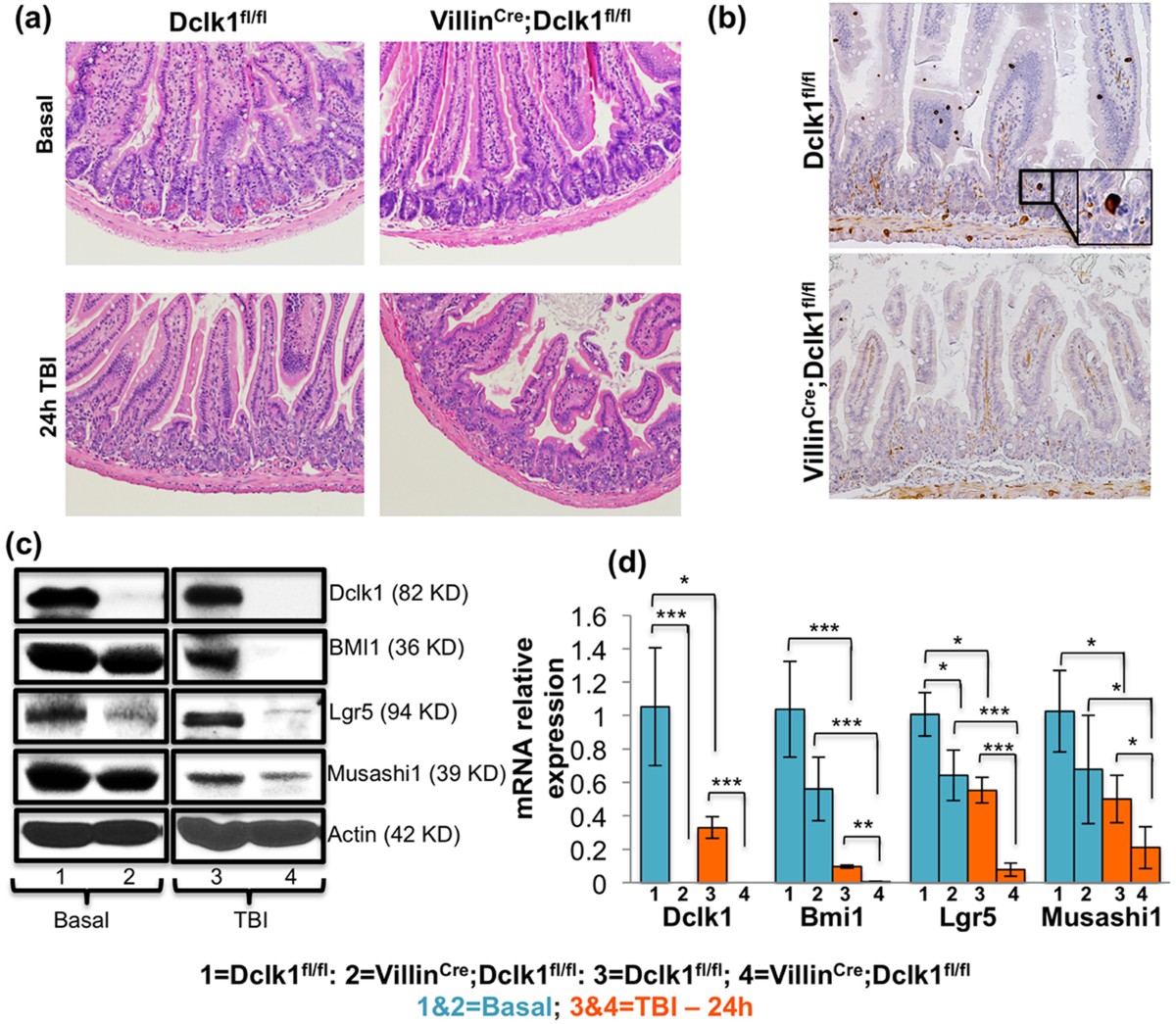 Intestinal tuft cells regulate the ATM mediated DNA Damage response via Dclk1 dependent mechanism for crypt restitution following radiation injury | Scientific Reports intestinal-tuft-cells-regulate-the-atm-mediated-dna-damage-response-via-dclk1-dependent-mechanism-for-crypt-restitution-following-radiation-injury-scientific-reports