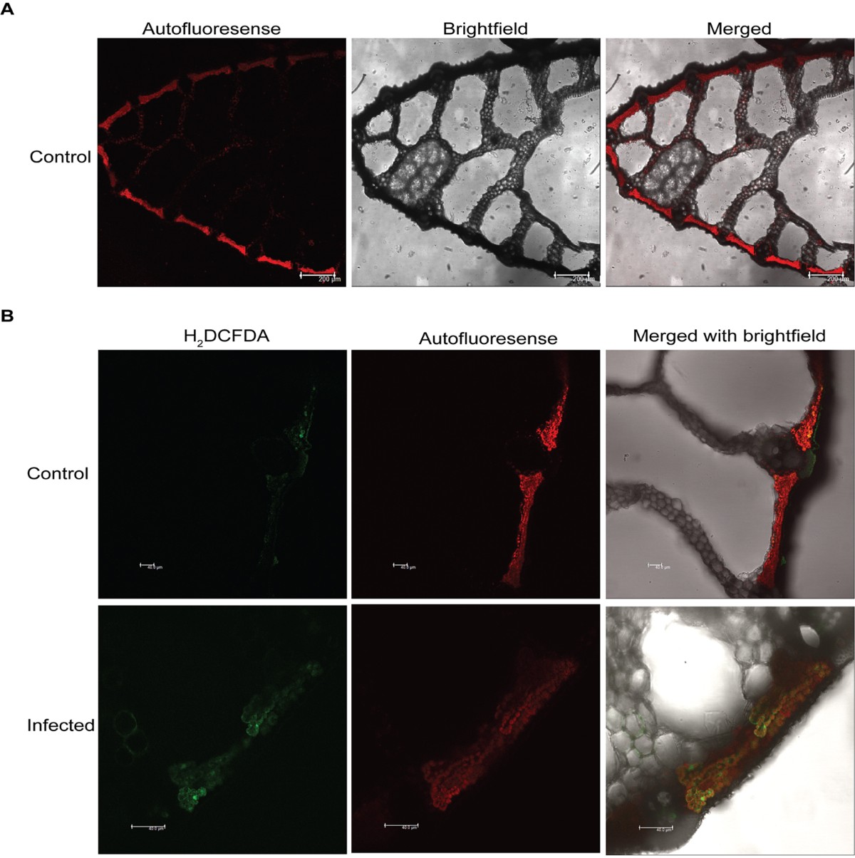 Alterations in rice chloroplast integrity, photosynthesis and metabolome  associated with pathogenesis of Rhizoctonia solani | Scientific Reports