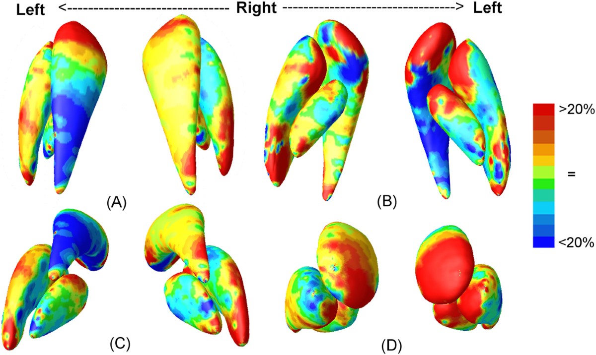 Mapping the basal ganglia alterations in children chronically exposed to  manganese | Scientific Reports