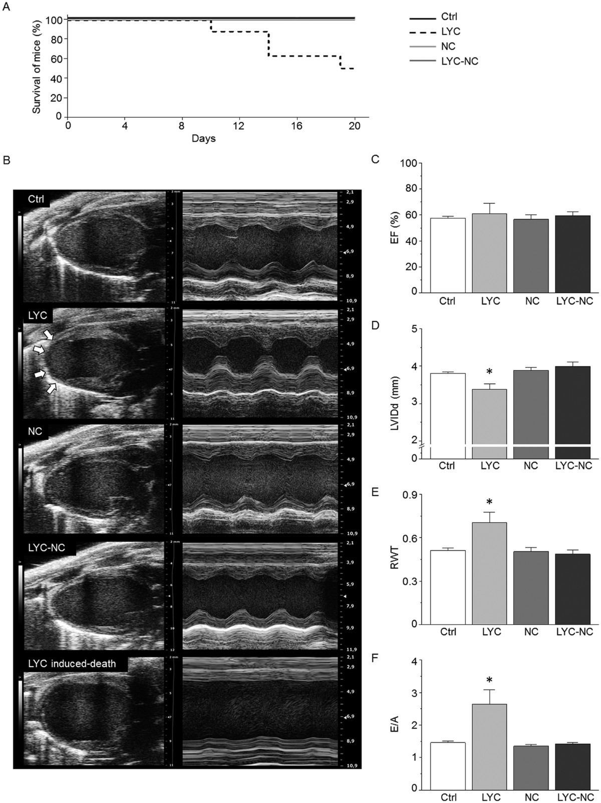 Biodegradable Polymeric Nanocapsules Prevent Cardiotoxicity of Anti-Trypanosomal Lychnopholide | Scientific Reports biodegradable-polymeric-nanocapsules-prevent-cardiotoxicity-of-anti-trypanosomal-lychnopholide-scientific-reports
