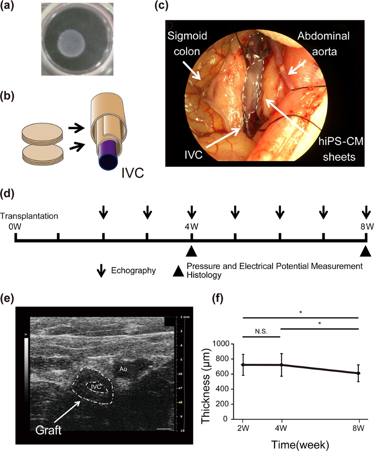 lsm nudes 026 A potential target for liver cancer management, lysophosphatidic acid  receptor 6 (LPAR6), is transcriptionally up-regulated by the NCOA3  coactivator - Journal of Biological Chemistry