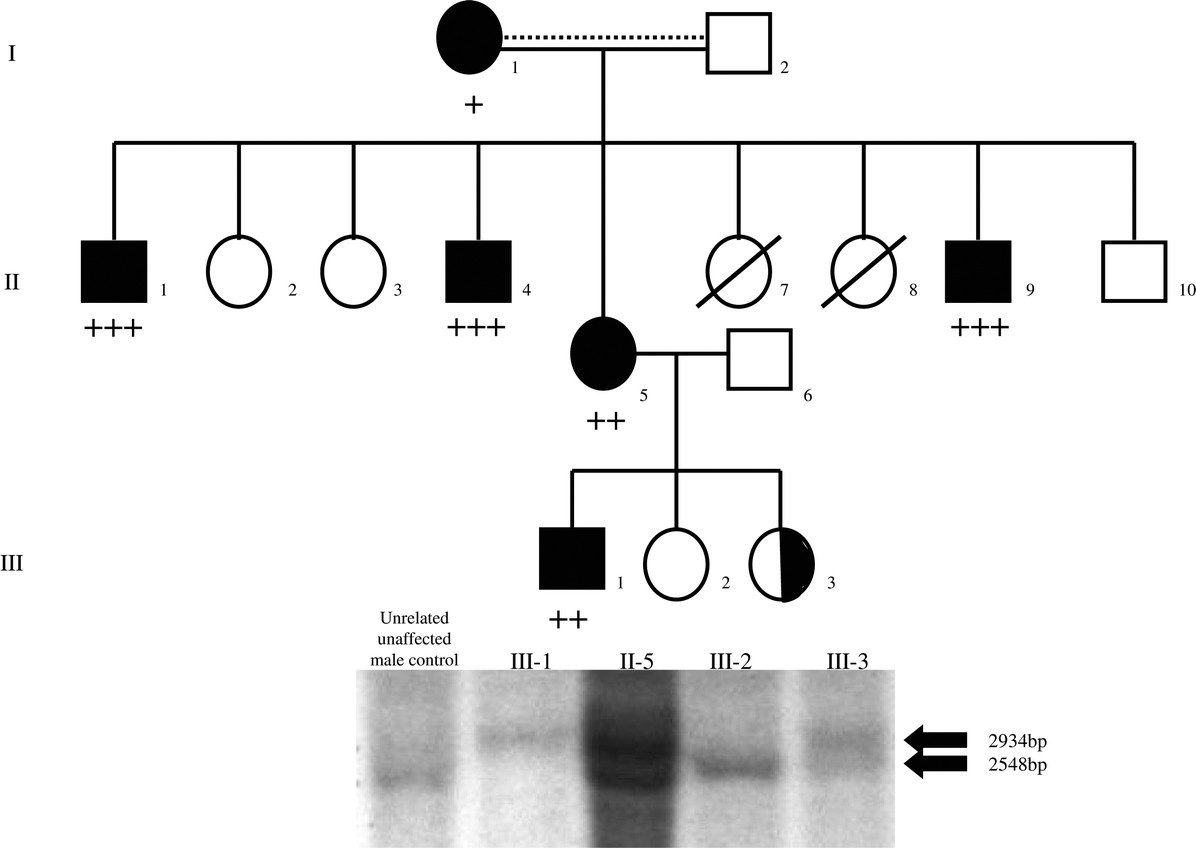 Novel mutations underlying nephrogenic diabetes insipidus in Arab ...