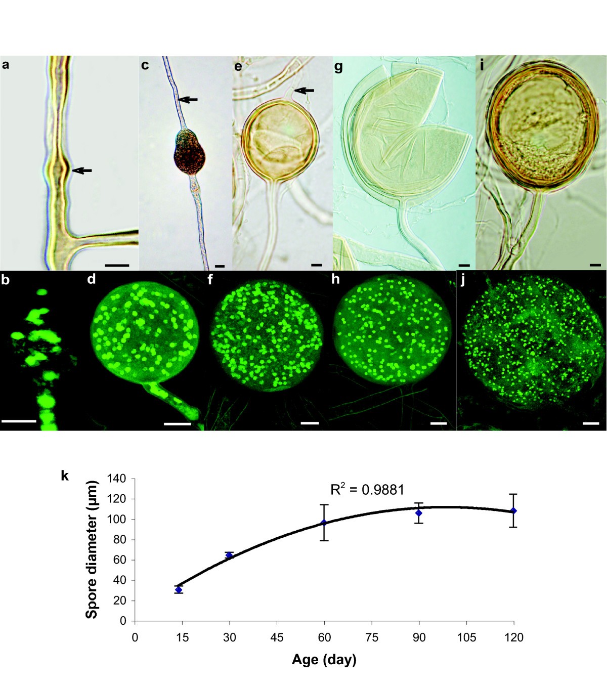 Spore development and nuclear inheritance in arbuscular mycorrhizal fungi |  BMC Ecology and Evolution | Springer Nature Link