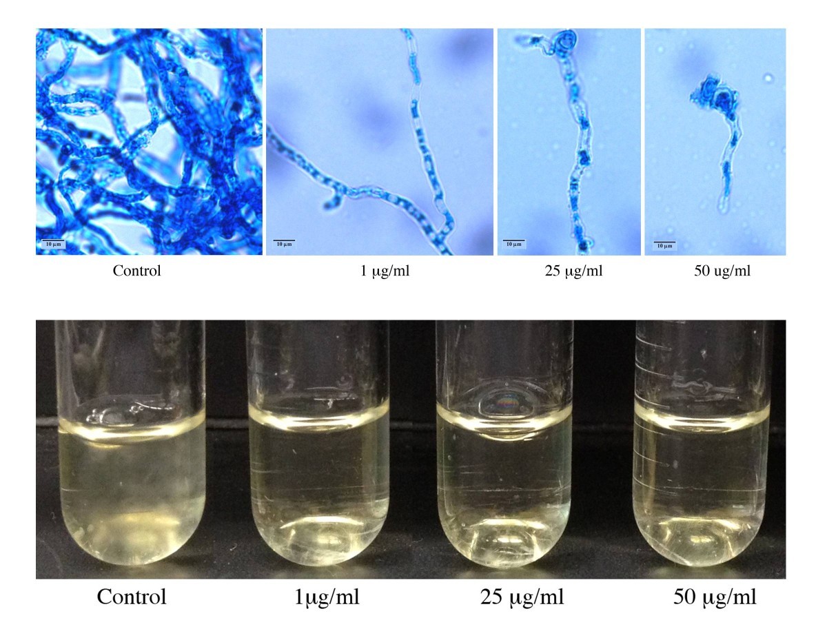 gssg glutathione oxidized Oncology Letters