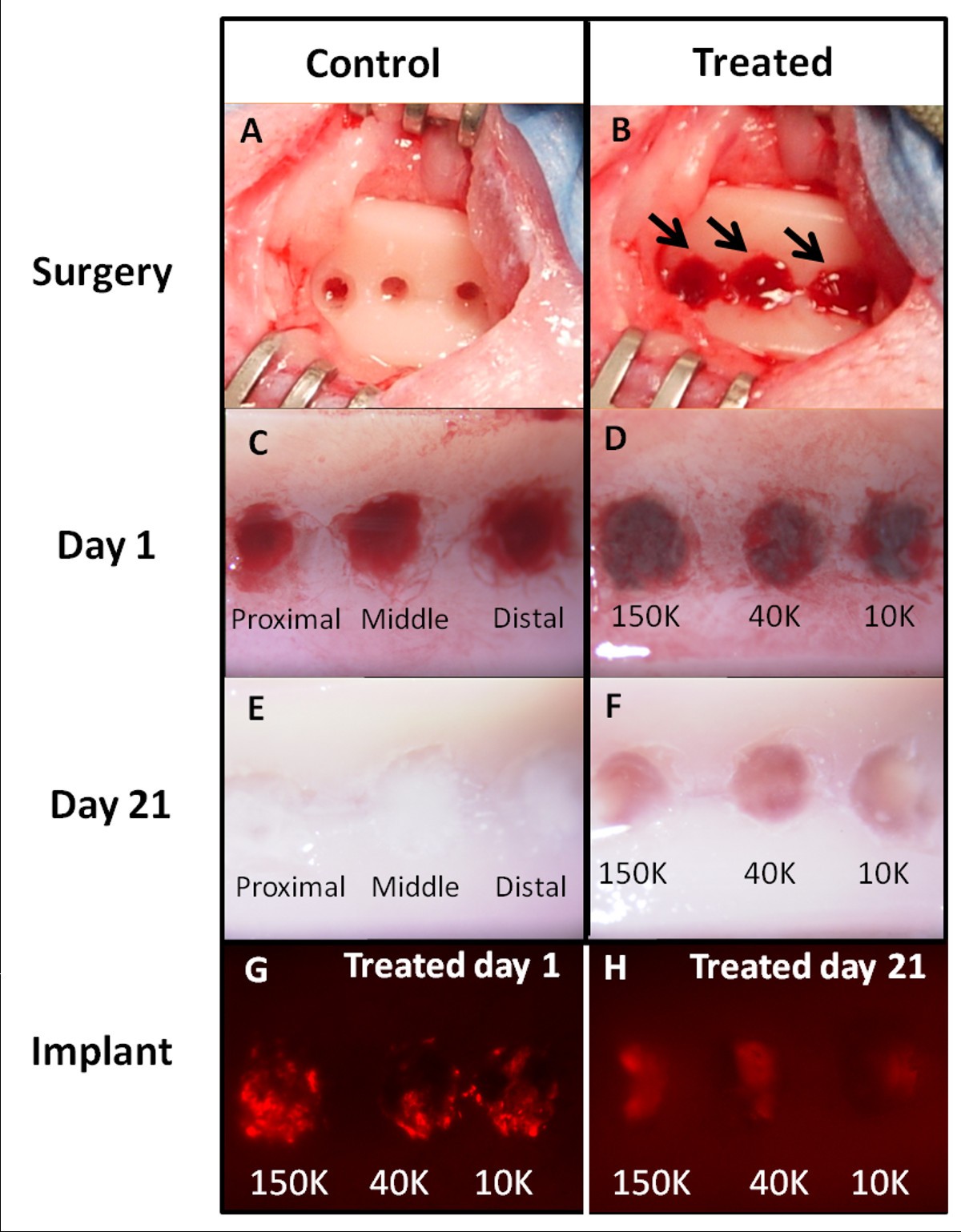 lsm.jpg4.us | imagesize: lsd-026" Subchondral pre-solidified chitosan/blood implants elicit reproducible  early osteochondral wound-repair responses including neutrophil and stromal  cell chemotaxis, bone resorption and repair, enhanced repair tissue  integration and delayed matrix ...