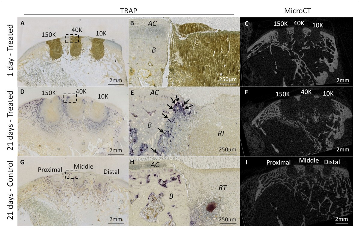 lsm.jpg4.us | imagesize: lsd-026" Subchondral pre-solidified chitosan/blood implants elicit reproducible  early osteochondral wound-repair responses including neutrophil and stromal  cell chemotaxis, bone resorption and repair, enhanced repair tissue  integration and delayed matrix ...