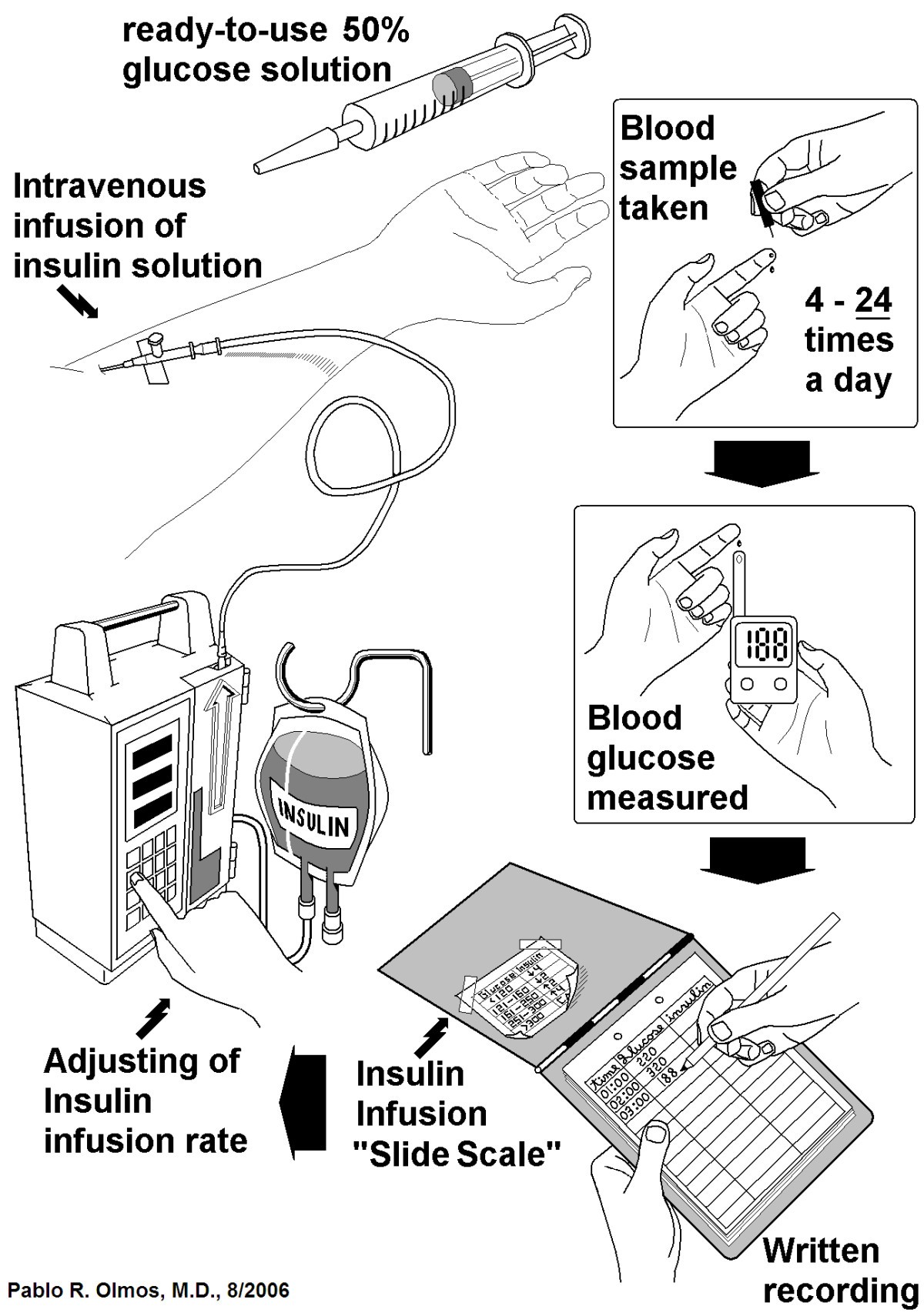 In silico evaluation of a control system and algorithm for automated insulin  infusion in the ICU setting | BioMedical Engineering OnLine | Springer  Nature Link
