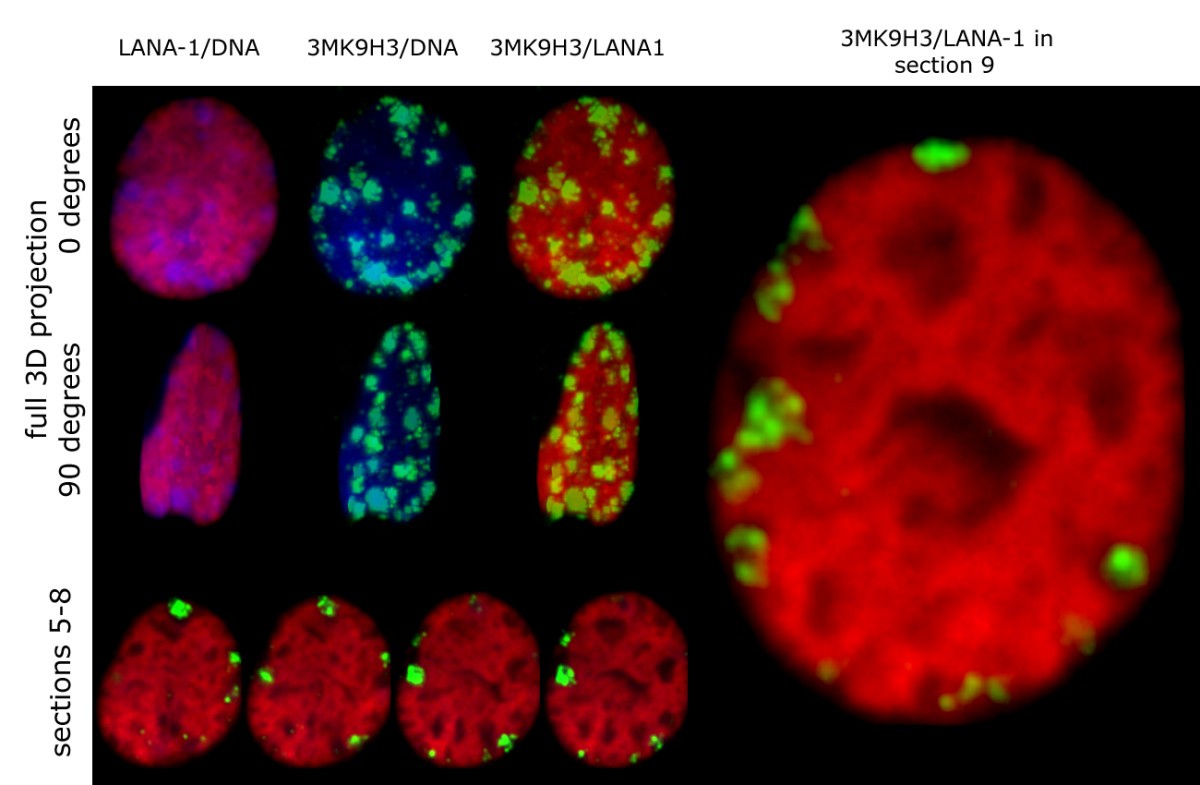 HHV-8 encoded LANA-1 alters the higher organization of the cell 