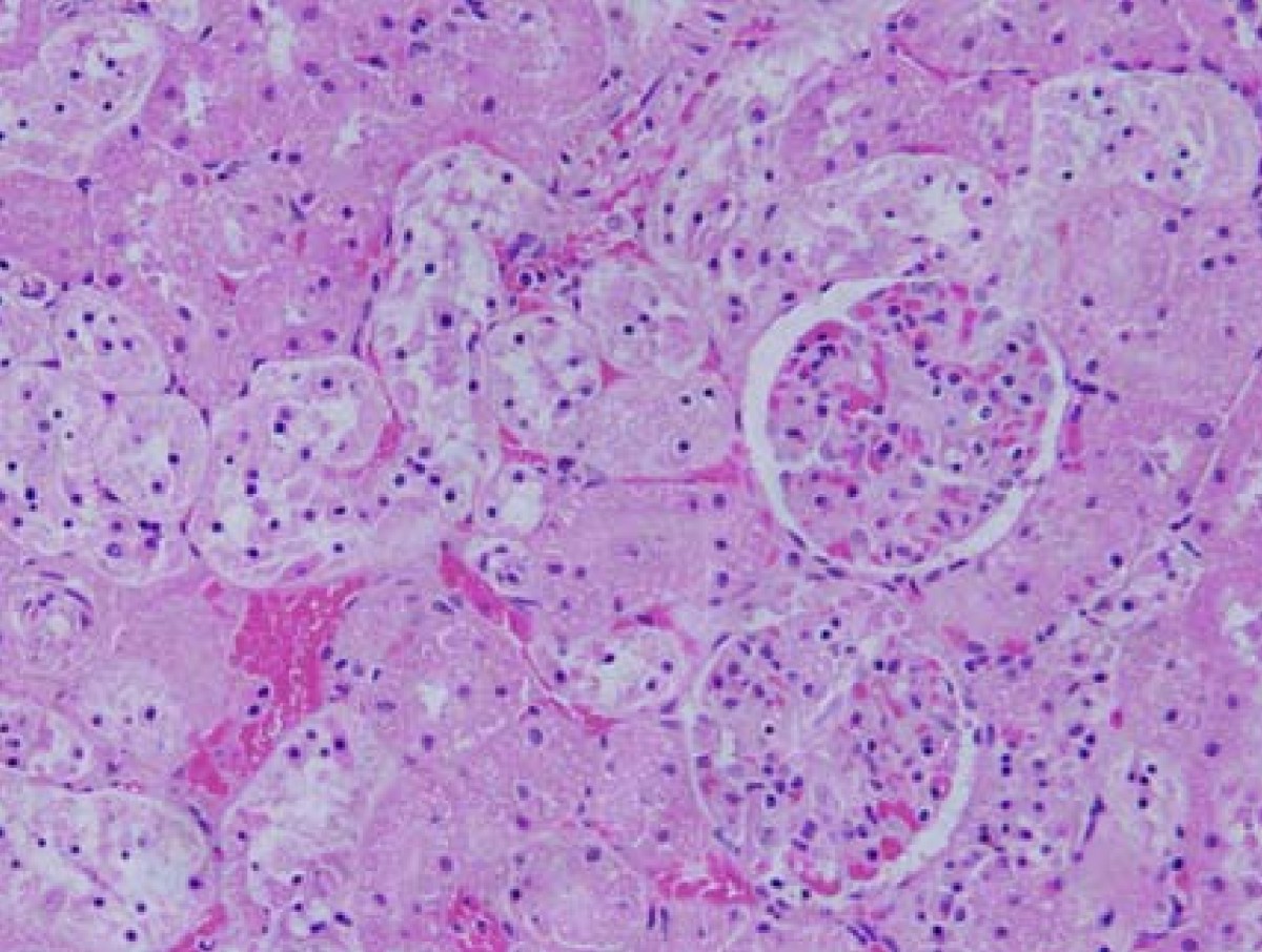 The appearance of renal cells cytoplasmic degeneration and nuclear  destruction might be an indication of GNPs toxicity | Lipids in Health and  Disease, image size:1200x906