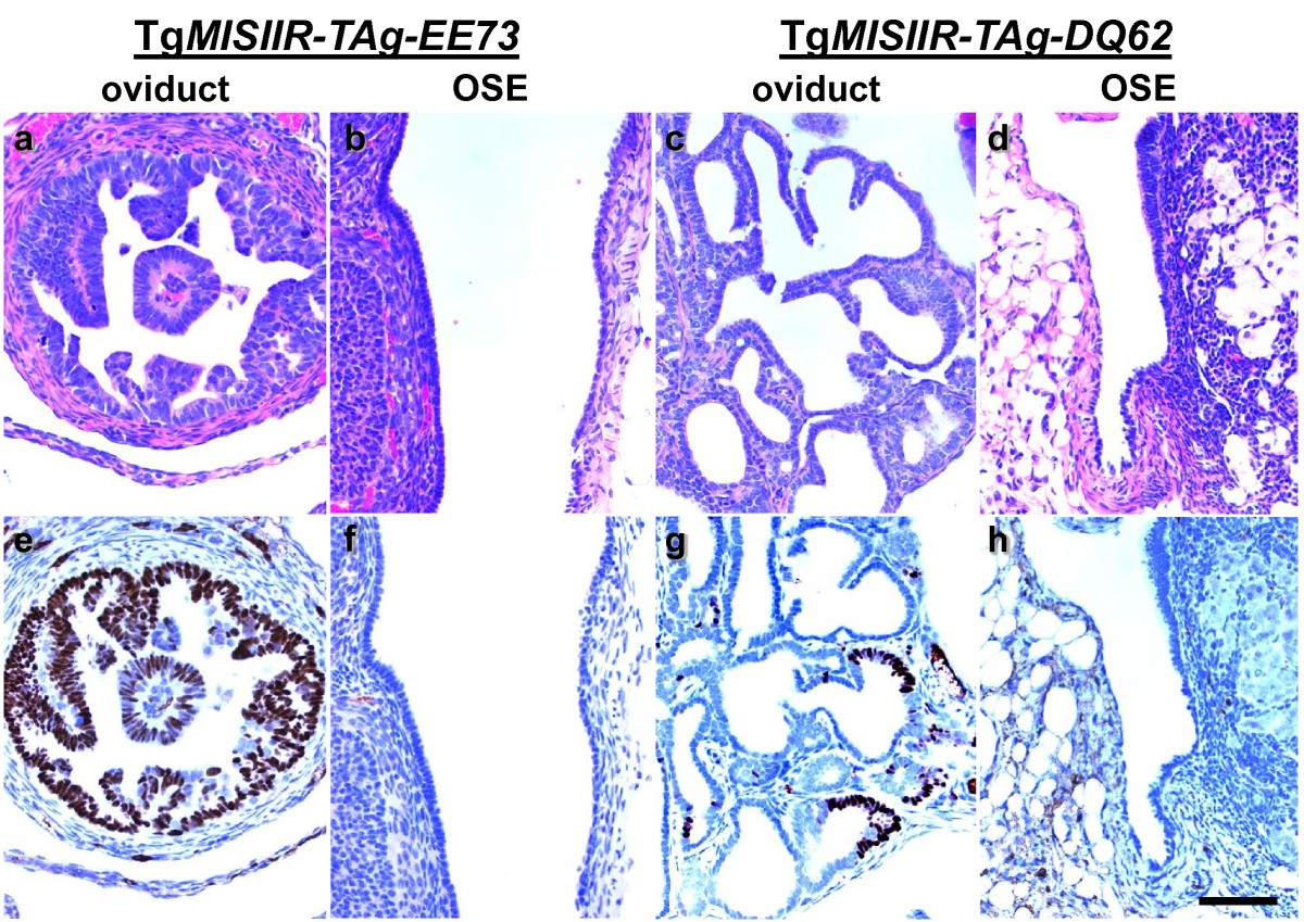 Development of a syngeneic mouse model of epithelial ovarian cancer |  Journal of Ovarian Research | Full Text