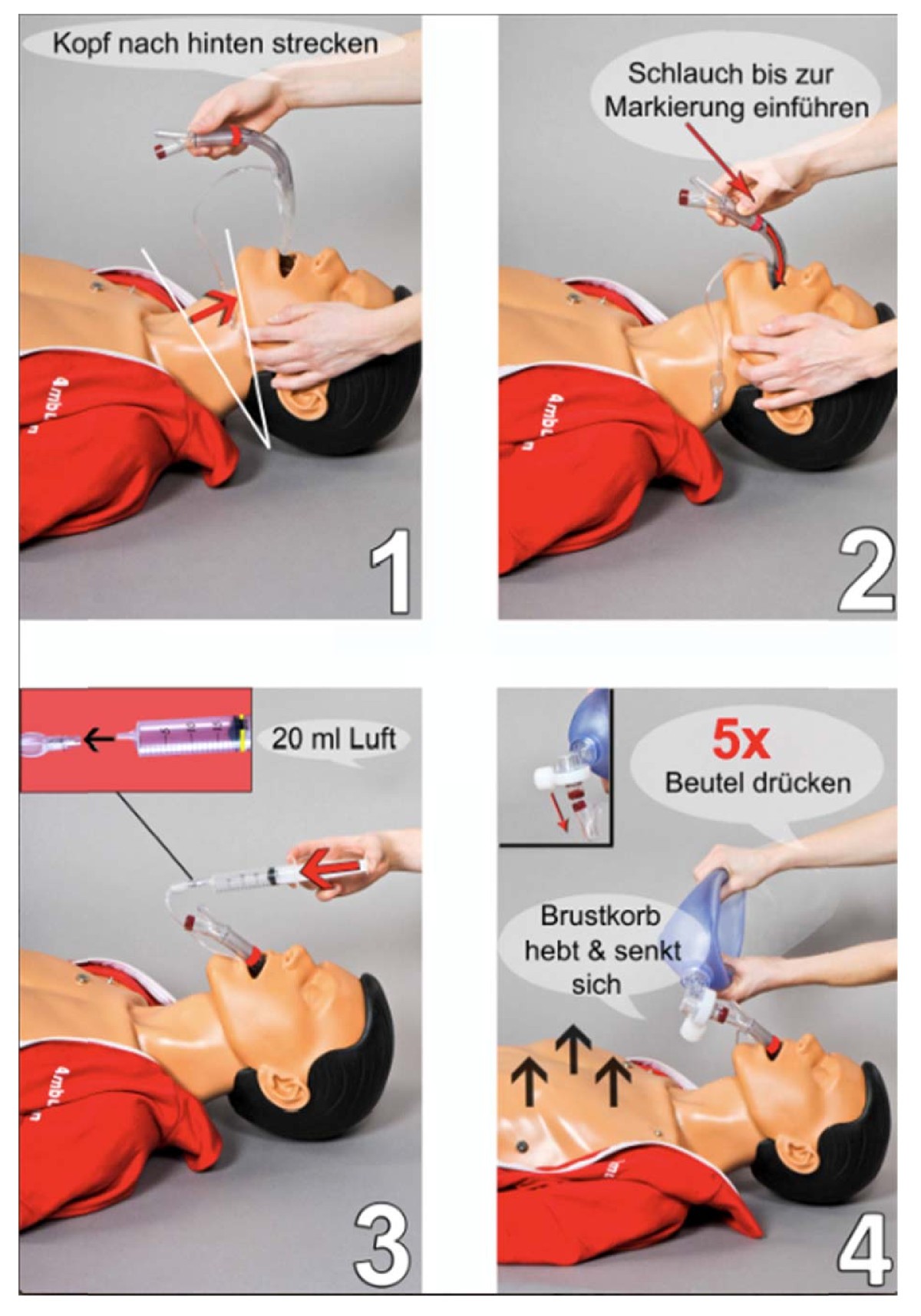 Does a 4 diagram manual enable laypersons to operate the laryngeal mask  supreme®? A pilot study in the manikin | Scandinavian Journal of Trauma,  Resuscitation and Emergency Medicine, image size:1200x1715