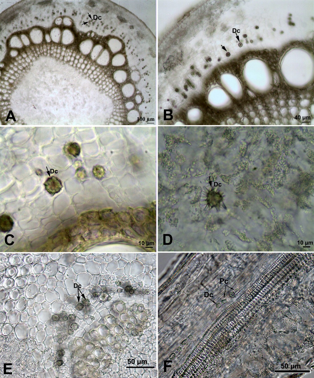 Occurrence, types and distribution of calcium oxalate crystals in leaves  and stems of some species of poisonous plants | Botanical Studies |  Springer Nature Link