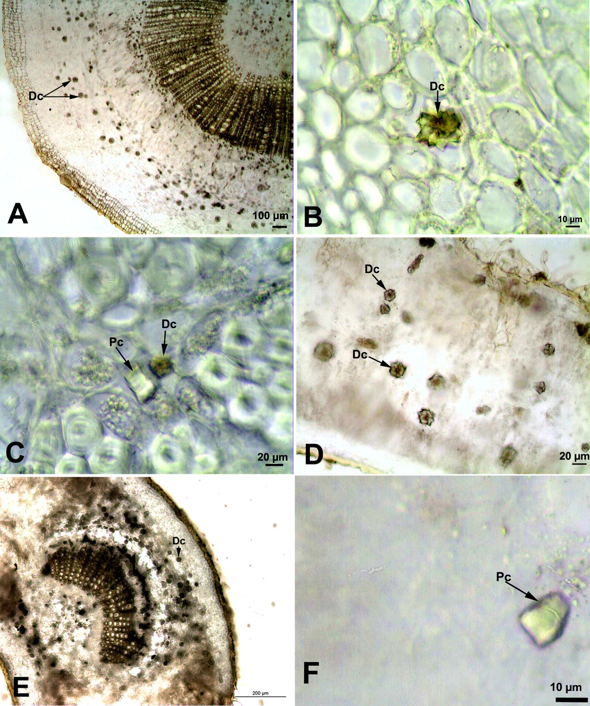 Occurrence, types and distribution of calcium oxalate crystals in leaves  and stems of some species of poisonous plants | Botanical Studies |  Springer Nature Link