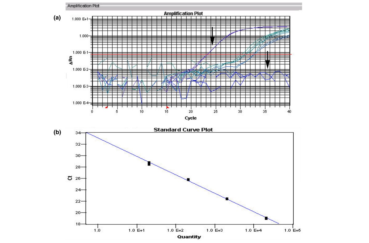 Systematic analysis of Epstein-Barr virus genes and their individual  contribution to virus production and composition | bioRxiv, image size:1200x791