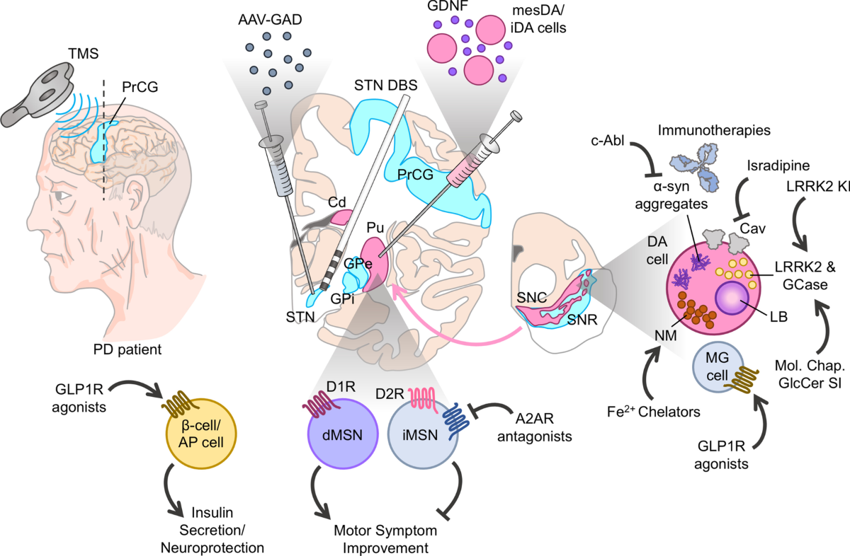 Novel targeted therapies for Parkinson's disease | Molecular Medicine
