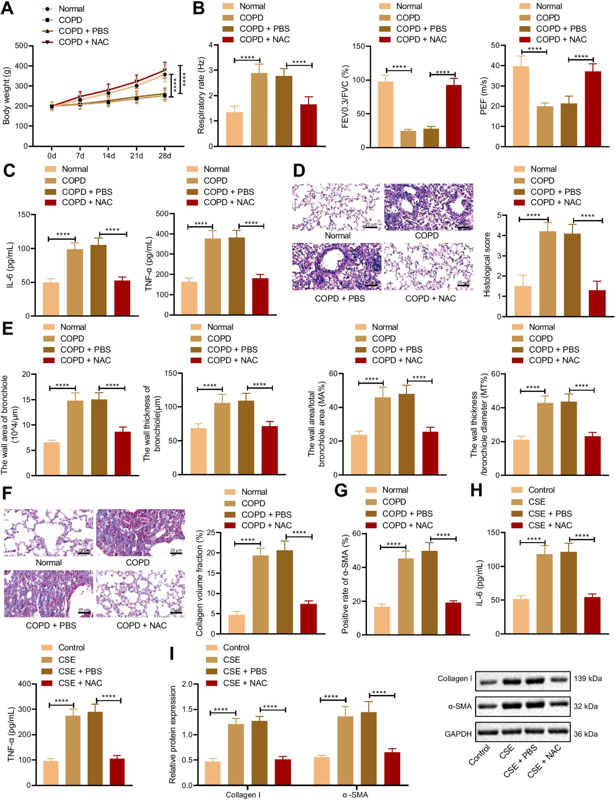 The antioxidant N-acetylcysteine promotes immune response and inhibits  epithelial-mesenchymal transition to alleviate pulmonary fibrosis in chronic  obstructive pulmonary disease by suppressing the VWF/p38 MAPK axis |  Molecular Medicine