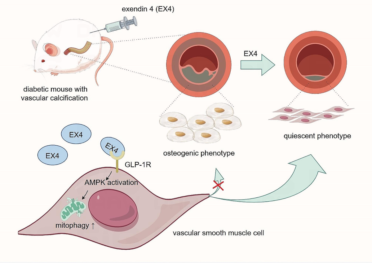 glp 1 agonist trade name GLP-1 Drugs May Trigger Muscle Loss In Cirrhosis Patients: Study