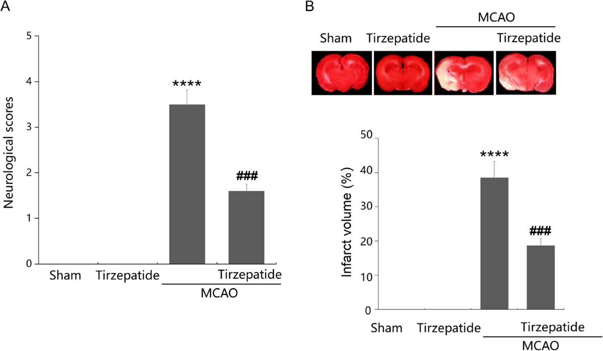 tirzepatide blood brain barrier Tirzepatide mitigates Stroke-Induced Blood-Brain barrier disruption by  modulating Claudin-1 and C/EBP-α pathways | Molecular Medicine