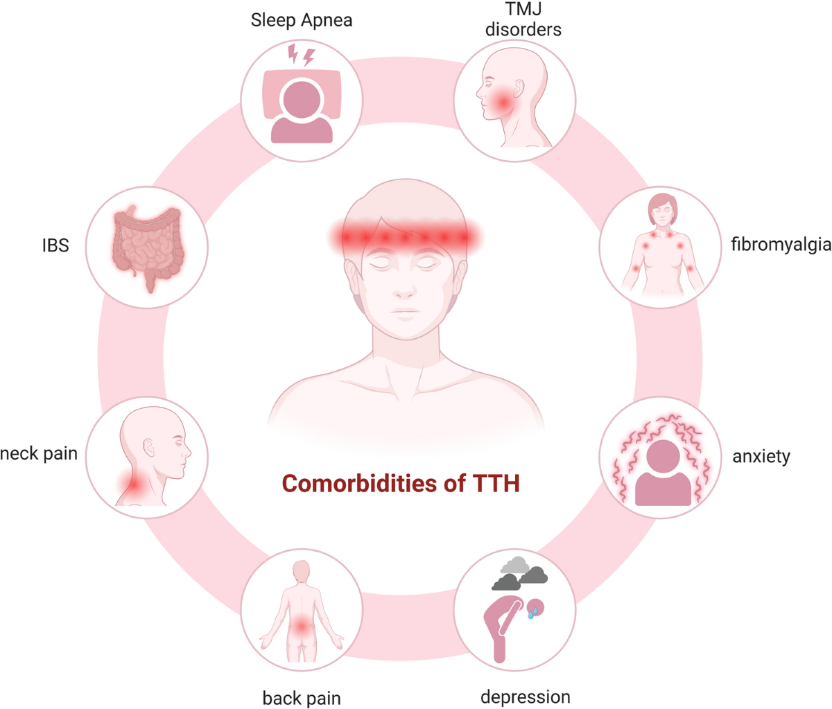 Which Manifestation is Most Consistent With a Secondary Headache: Unveiling Clarity