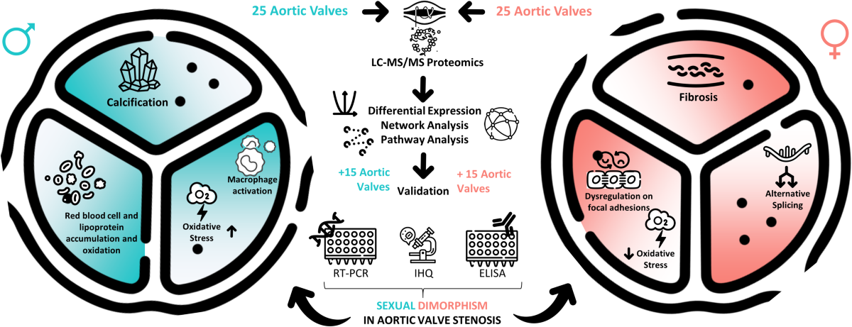 Dissecting sexual dimorphism in aortic valve stenosis by 