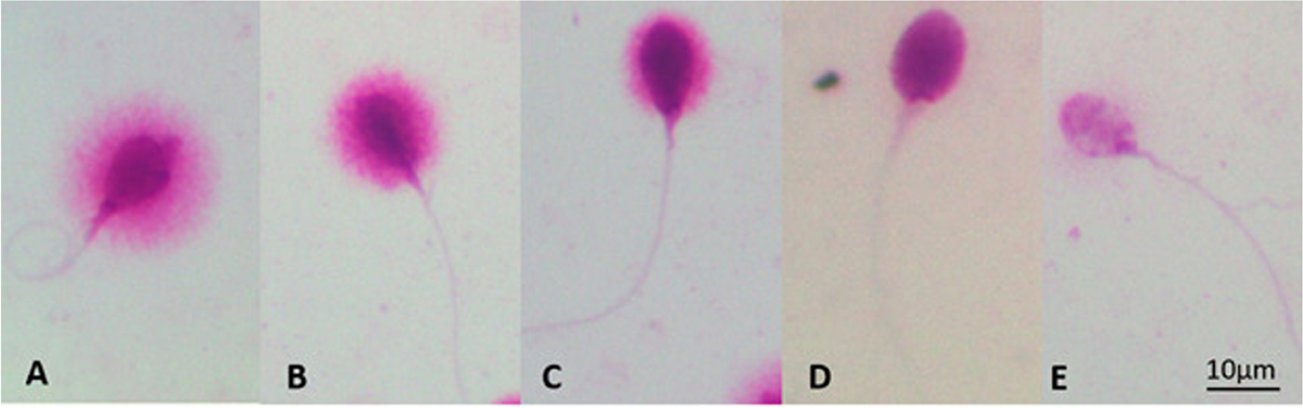 glutathione benefits for sperm Best Male Fertility Supplements: Evidence-Based Guide