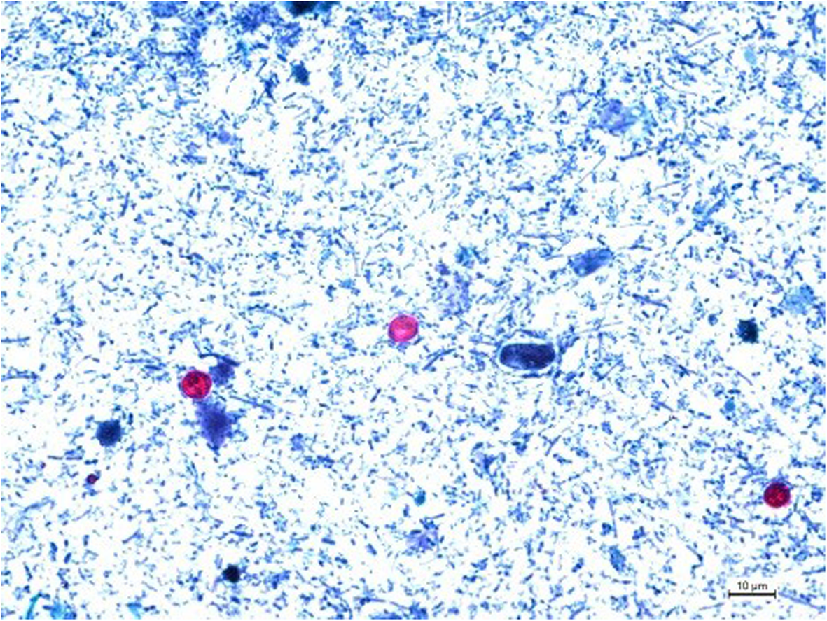 Crypto maladie (72) foto