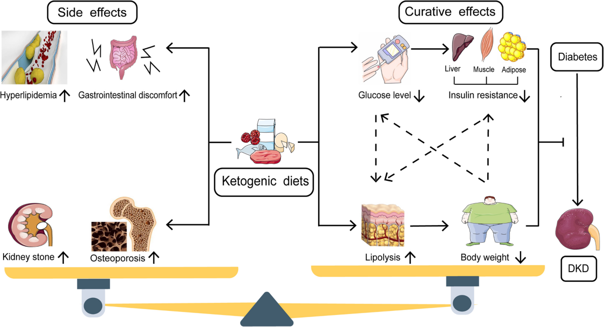 Ketogenic diets and -hydroxybutyrate in the prevention and treatment of diabetic kidney disease: current progress and future perspectives | BMC Nephrology | Springer Nature Link Ketogenic diets and -hydroxybutyrate in the prevention and treatment of diabetic kidney disease: current progress and future perspectives | BMC Nephrology | Springer Nature Link