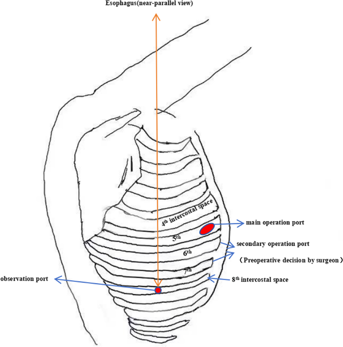 4.Intercostal space of thorax anatomy human | PDF, image size:1200x1214