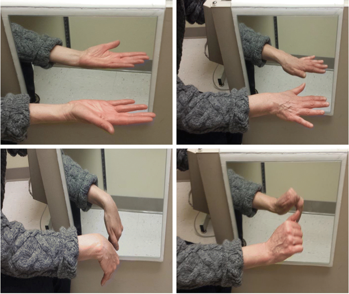 graded motor imagery cards Amazon.com: OPTP NOI Recognise Hand Flash Cards — Perform Graded Motor  Imagery Techniques to Test Left/Right Discrimination Abilities —  Non-Returnable : Industrial & Scientific