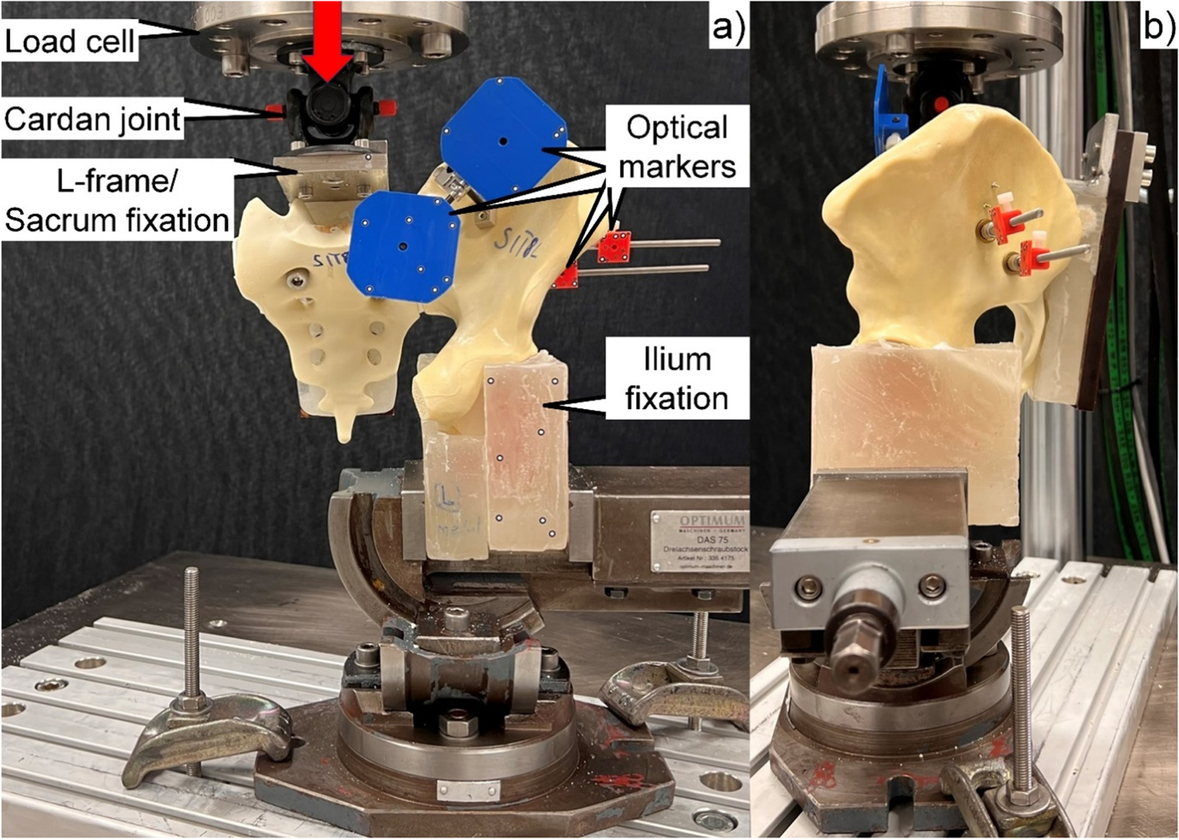 Evaluation of Cannulated Compression Headless Screw (CCHS) as an  alternative implant in comparison to standard S1-S2 screw fixation of the  posterior pelvis ring: a biomechanical study | BMC Musculoskeletal  Disorders | Springer