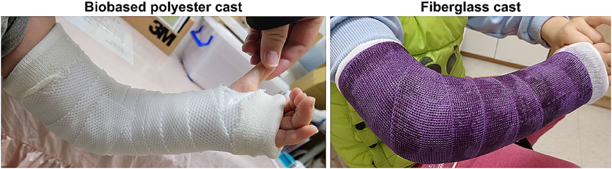 Biobased polyester versus synthetic fiberglass casts for treating 
