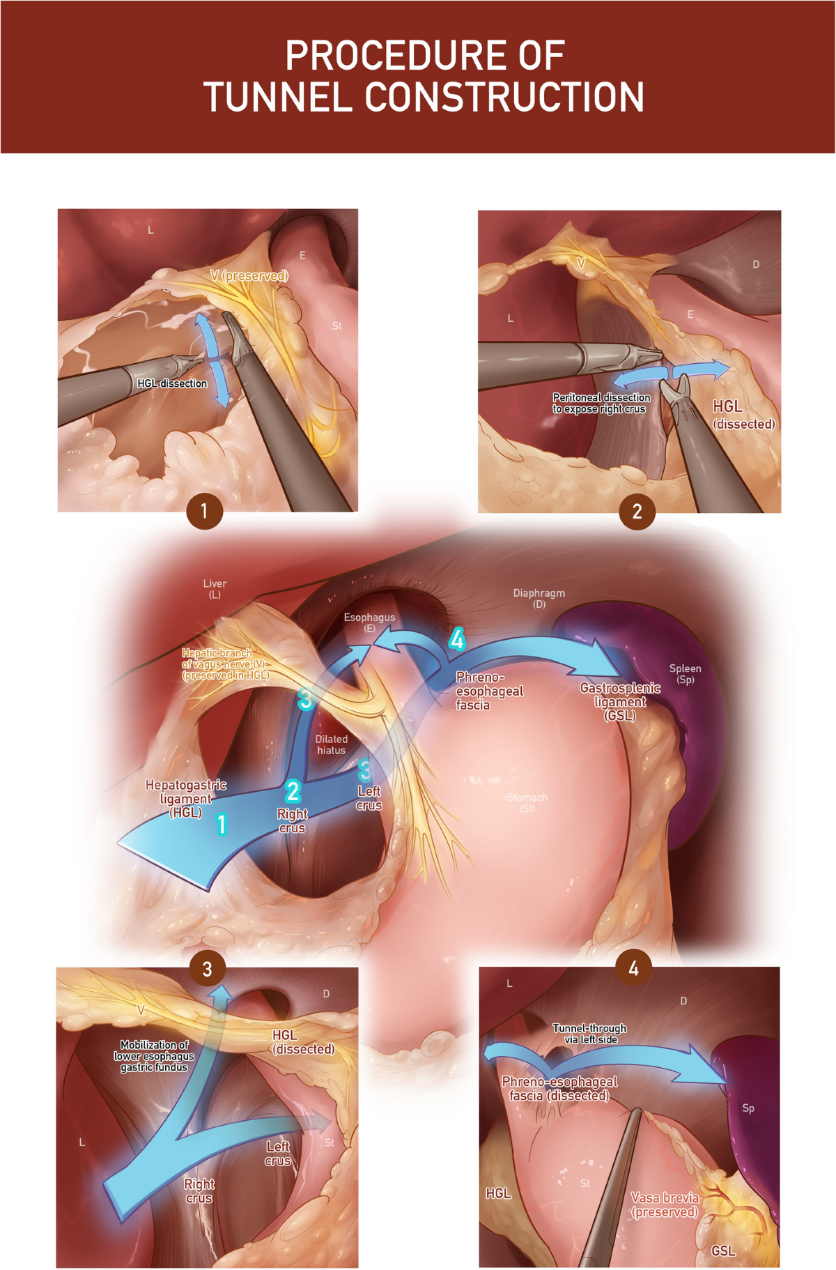 ghk cu peptide dosage injection How Much Bac Water for 50mg GHK-Cu? Reconstitution Advice