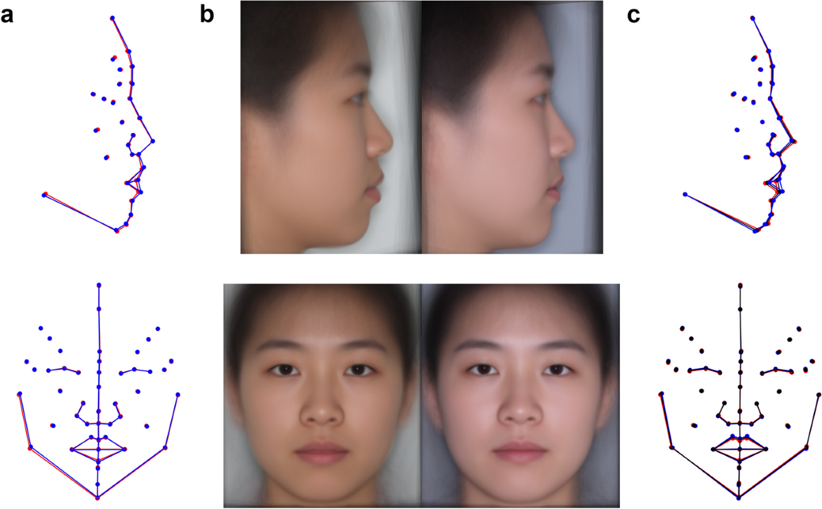 Morphometric evaluation of the face contours/volumes. (a) Face contour
