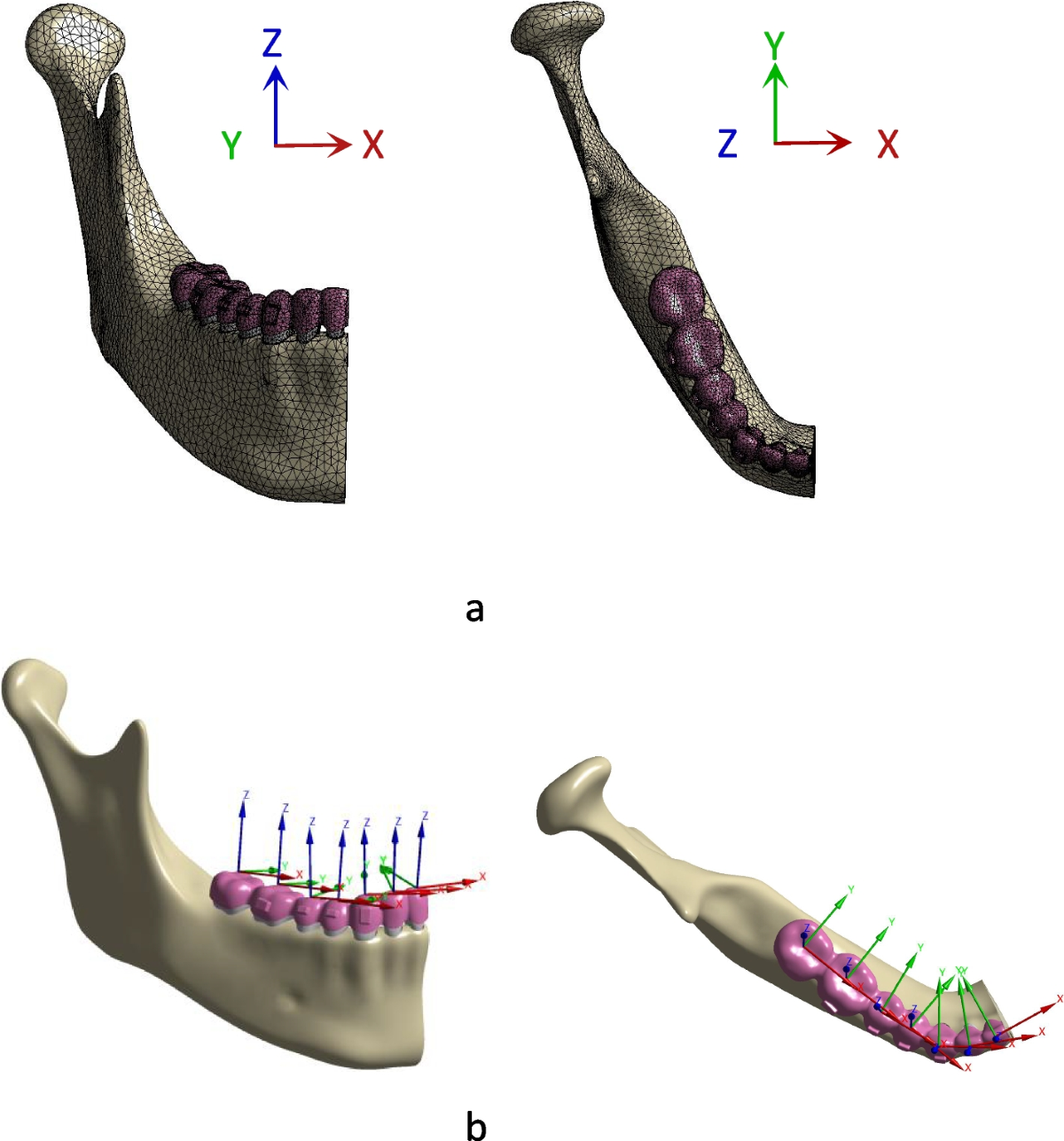 Effects of different patterns of movement for correcting a deep curve of  Spee with clear aligners on the anterior teeth: a finite element analysis |  BMC Oral Health | Springer Nature Link
