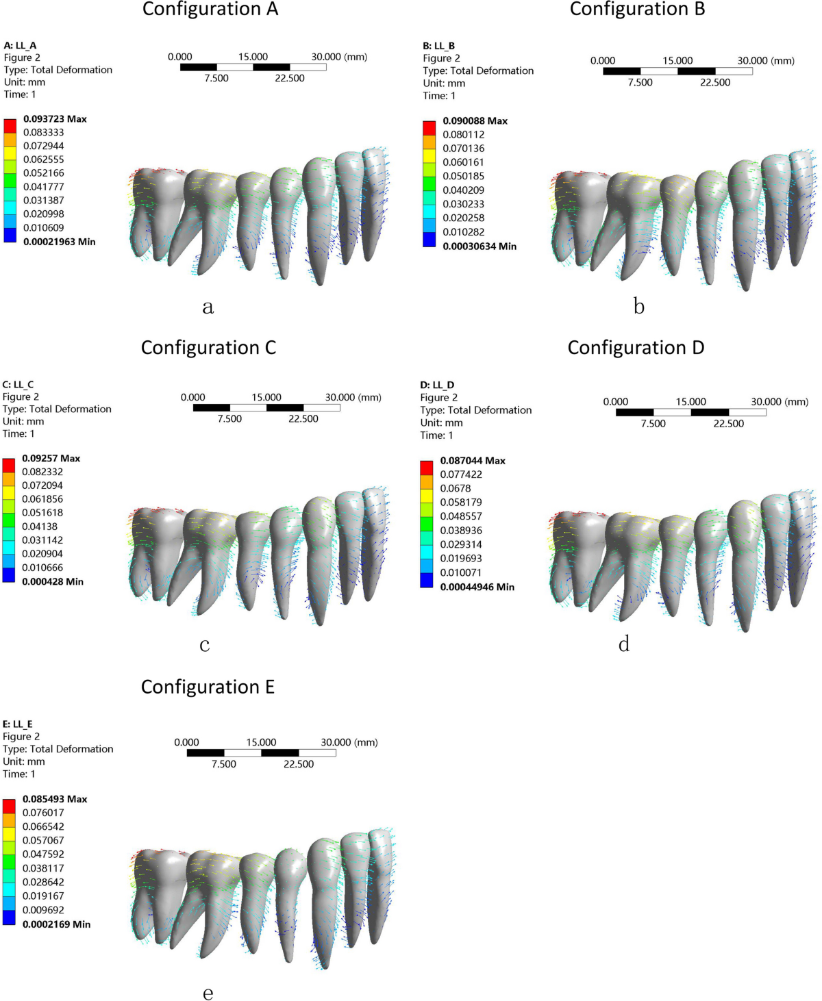 Effects of different patterns of movement for correcting a deep curve of  Spee with clear aligners on the anterior teeth: a finite element analysis |  BMC Oral Health | Springer Nature Link