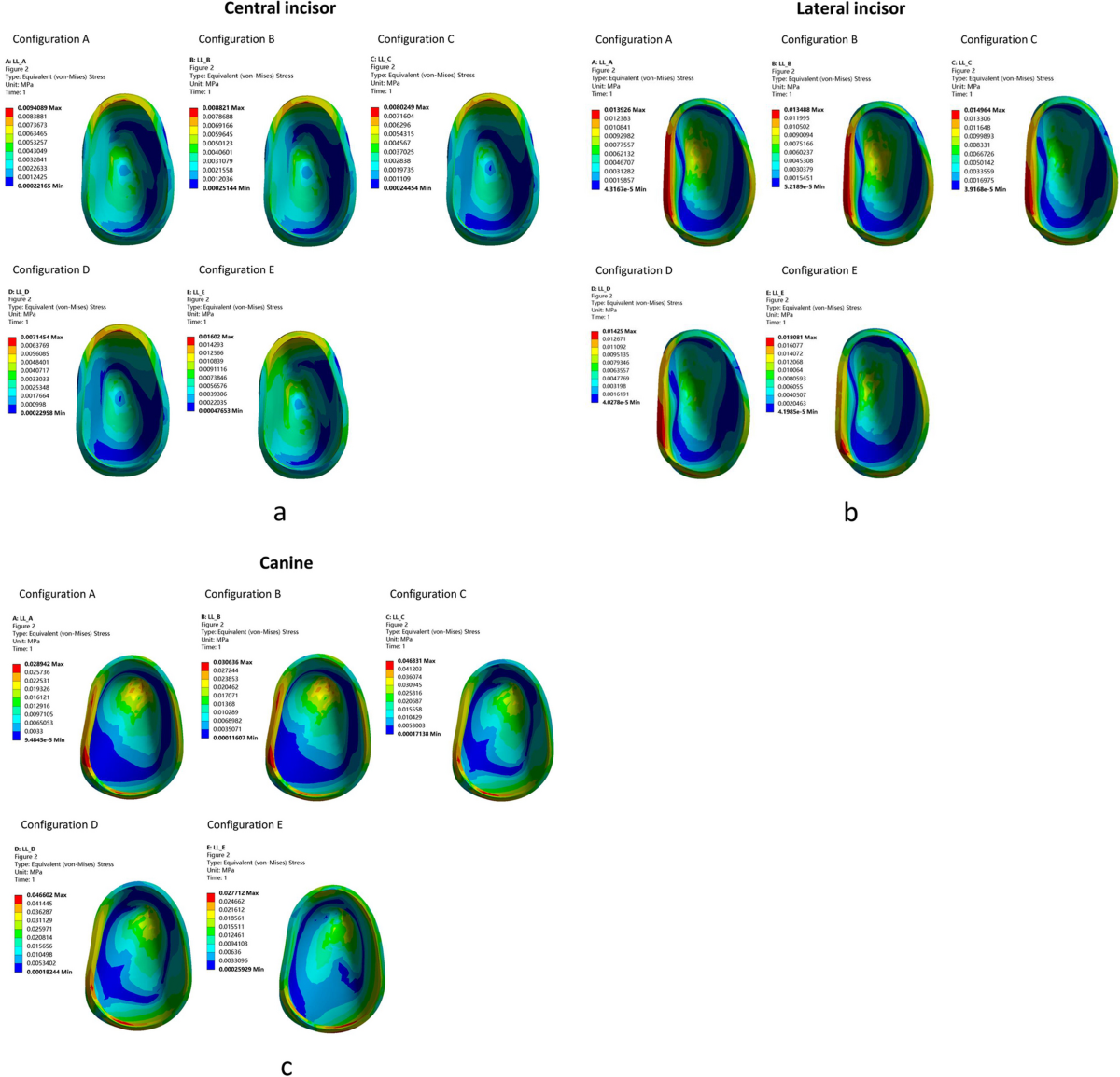 Effects of different patterns of movement for correcting a deep curve of  Spee with clear aligners on the anterior teeth: a finite element analysis |  BMC Oral Health | Springer Nature Link