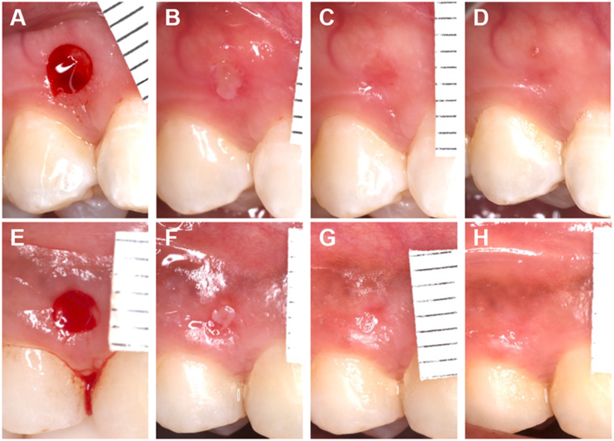 bpc 157 tb4 mgf kpv BPC-157: Miracle Healing Peptide or Hidden Danger?