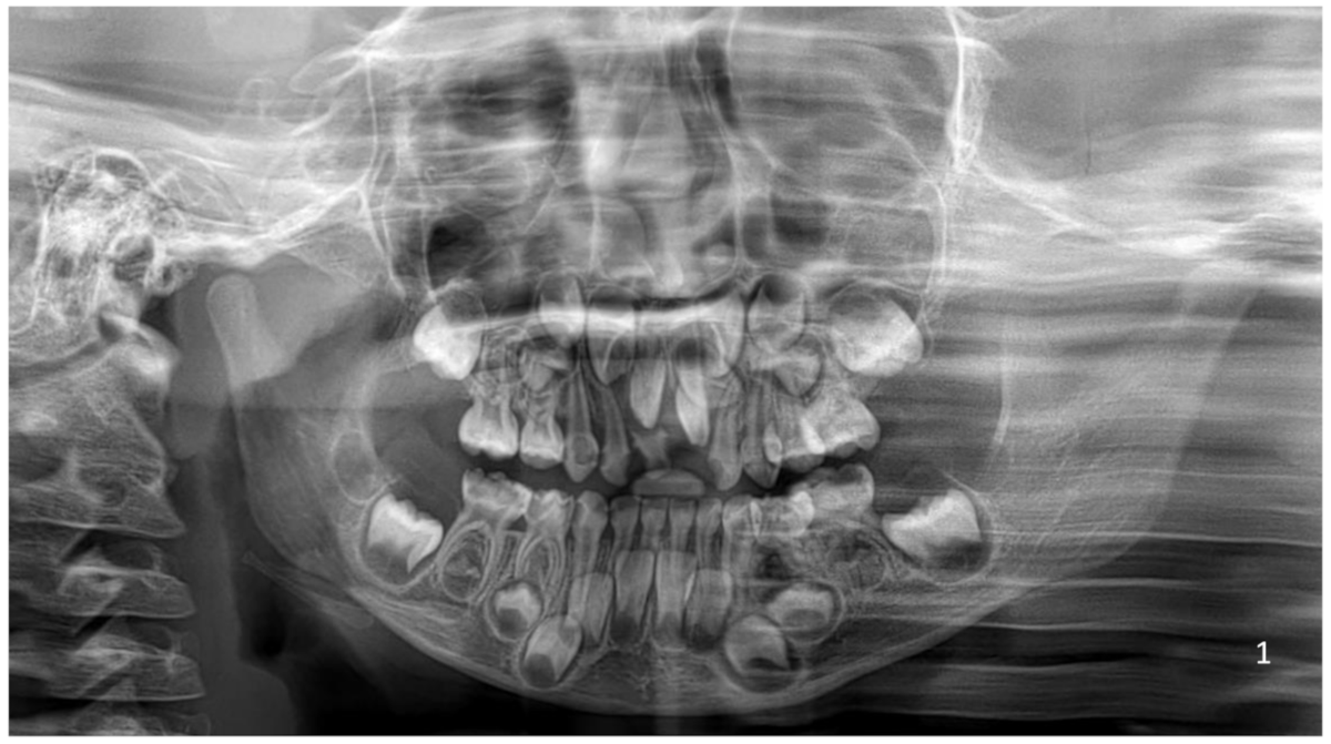 Developmental and Acquired Abnormalities of the Teeth - Dental Clinics, image size:1200x671