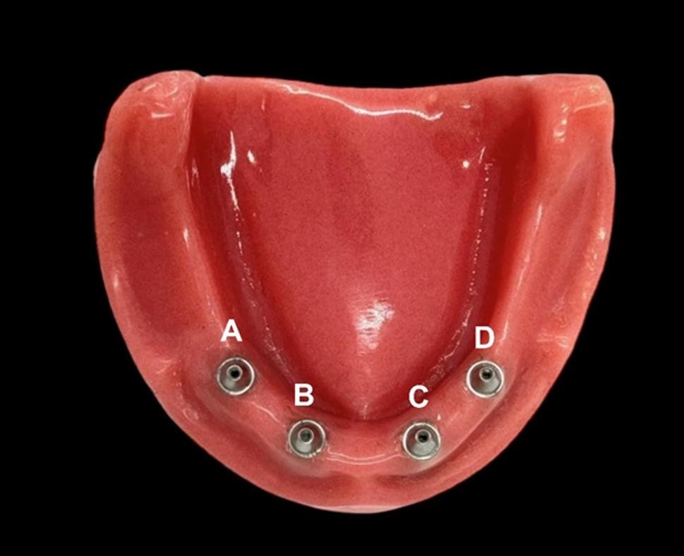 In vitro analysis of 3D-printed implant casts: how print orientation affects accuracy in full arch implant casts? | BMC Oral Health | Springer Nature Link In vitro analysis of 3D-printed implant casts: how print orientation affects accuracy in full arch implant casts? | BMC Oral Health | Springer Nature Link