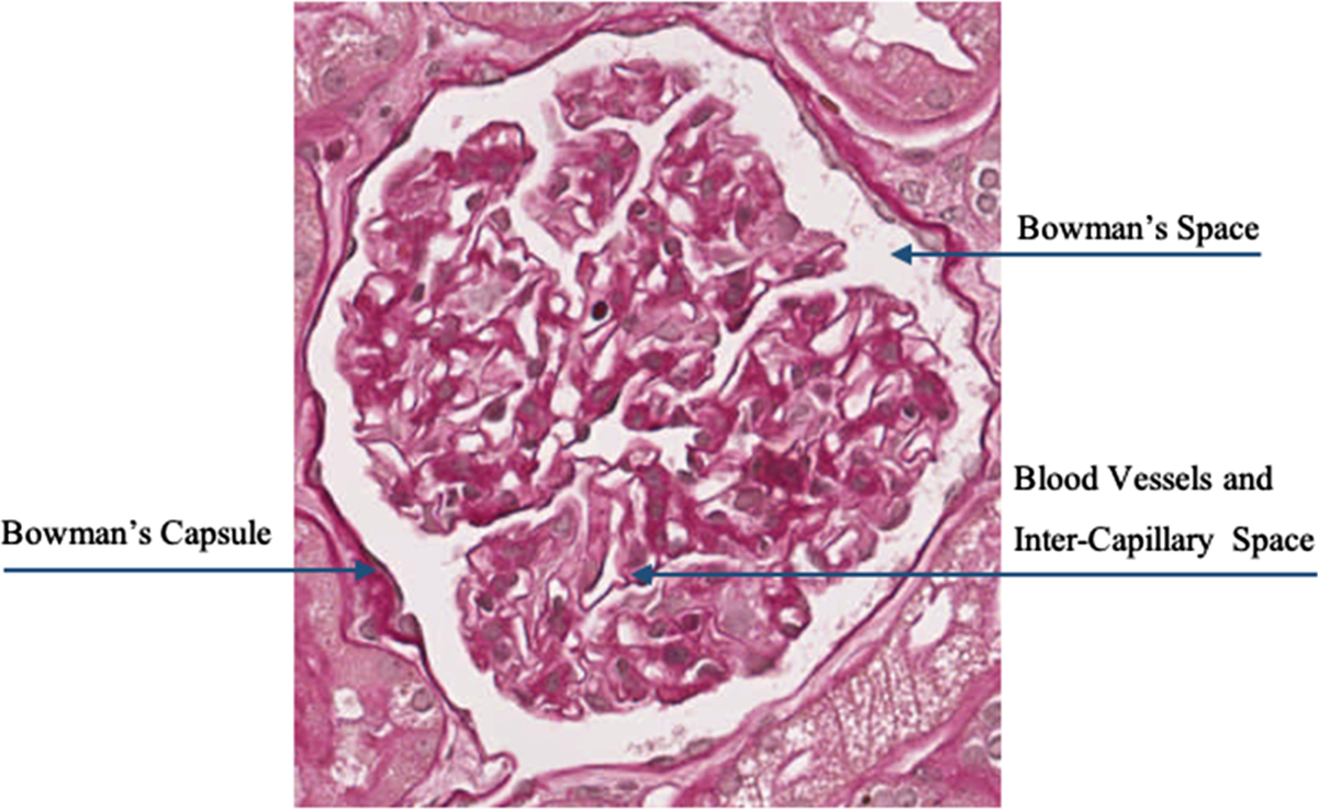 A neural network for glomerulus classification based on histological images  of kidney biopsy | BMC Medical Informatics and Decision Making, image size:1200x737