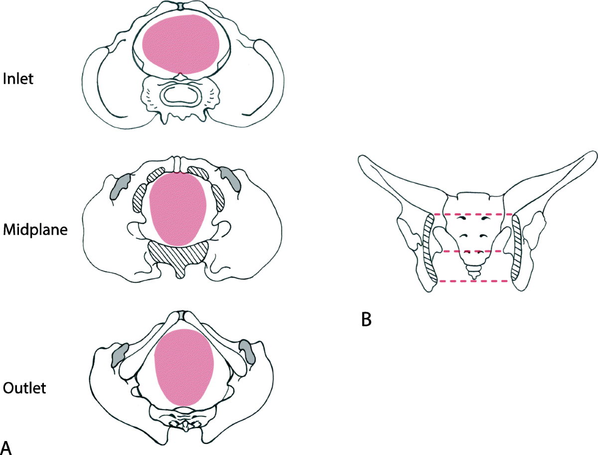Solved 5. Each pelvis was examined, and the following | Chegg.com, image size:1200x912