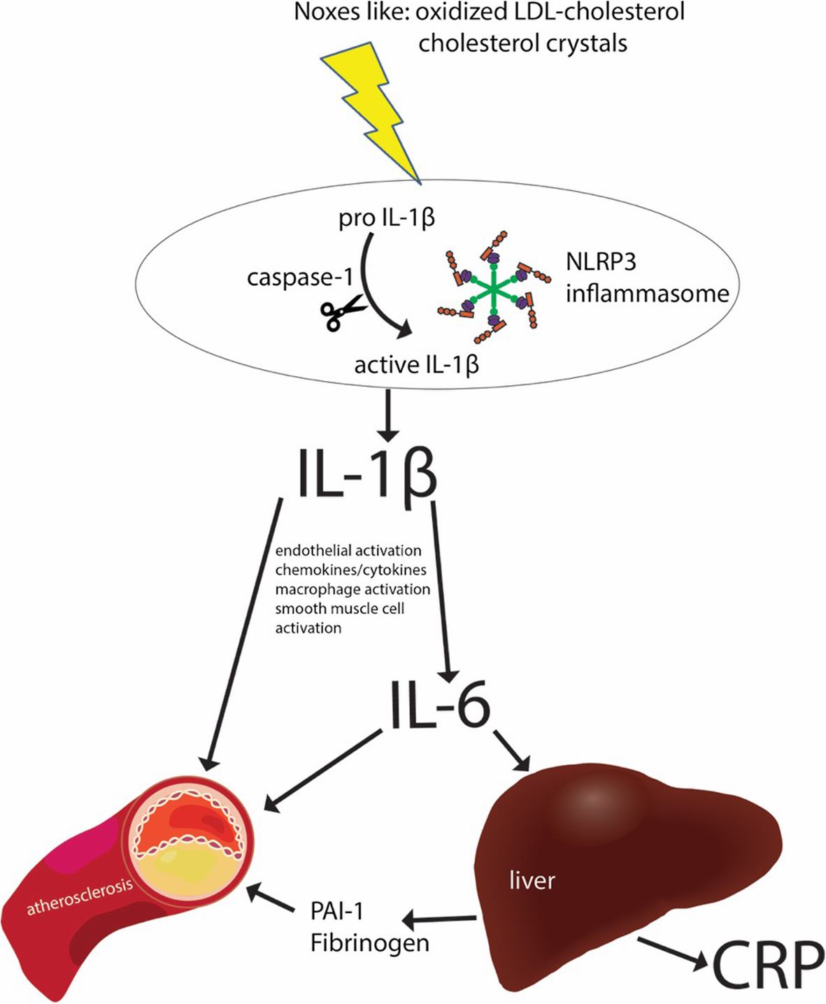 lipid pnl c ldl Advances in lipid-lowering therapy through gene-silencing technologies Low-density lipoprotein cholesterol and atherosclerosis.